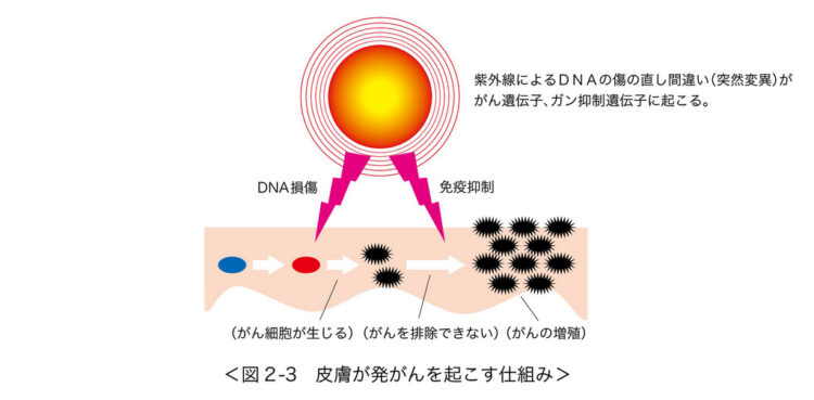 紫外線によって皮膚がんが引き起こされることも