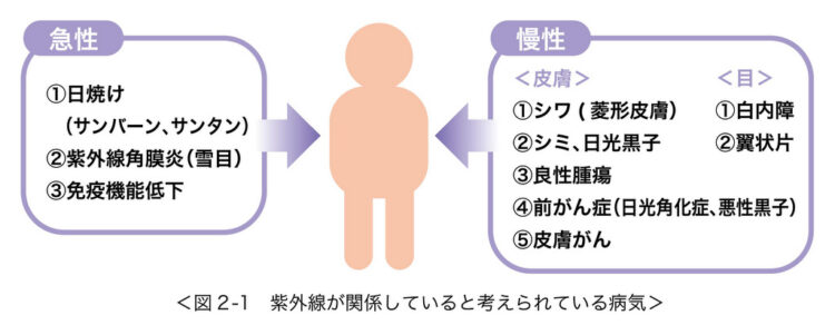 紫外線が影響するとされる病気